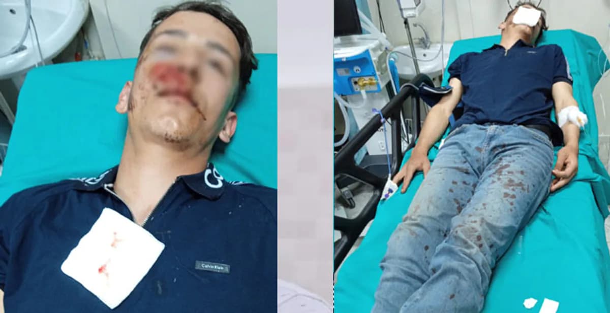 Hakkari Durankaya'da Darp Şoku: 17 Yaşındaki Genç Yaralandı, 4 Gözaltı Hakkari Durankaya'da Darp Şoku: 17 Yaşındaki Genç Yaralandı, 4 Gözaltı