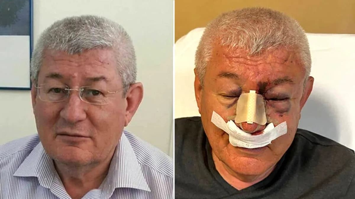 Uşak'ta SOL Parti İl Sözcüsüne Saldırı: "Muhalefete Gözdağı" İddiası Uşak'ta SOL Parti İl Sözcüsüne Saldırı: "Muhalefete Gözdağı" İddiası