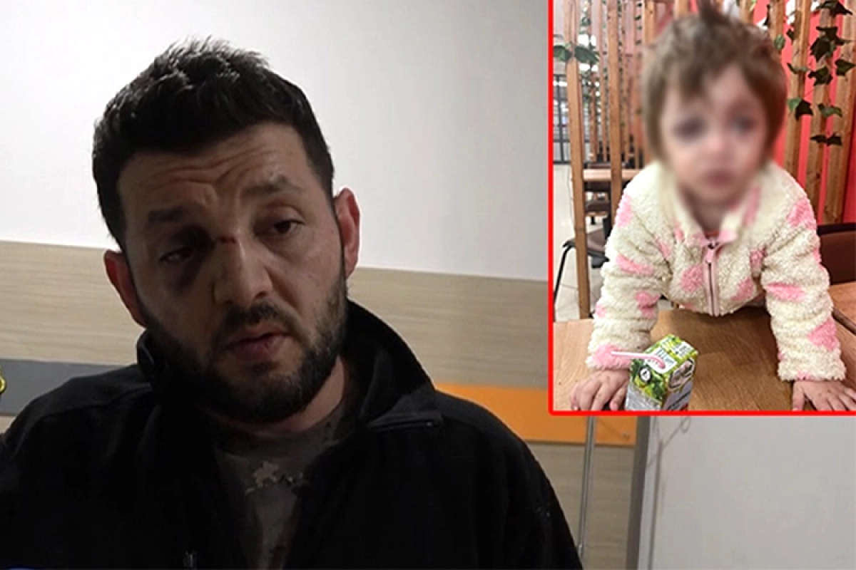 Esenköy'de 14 Aylık Bebeğe Saldırı Davasında Sanık: 