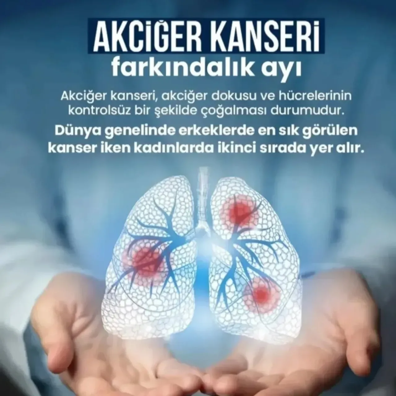 Kasım Ayı Tüm Dünyada Akciğer Kanseri Farkındalık Ayı Olarak Kabul Edildi Kasım Ayı Tüm Dünyada Akciğer Kanseri Farkındalık Ayı Olarak Kabul Edildi