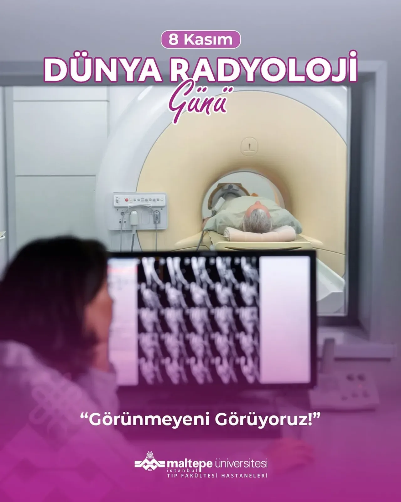 Dünya Radyoloji Günü'nde Erken Teşhisin Önemi Vurgulandı Dünya Radyoloji Günü'nde Erken Teşhisin Önemi Vurgulandı