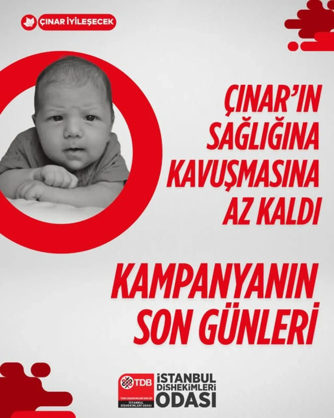 İstanbul Diş Hekimleri Odası, SMA Hastası Çınar İçin Yardım Kampanyası Başlattı İstanbul Diş Hekimleri Odası, SMA Hastası Çınar İçin Yardım Kampanyası Başlattı