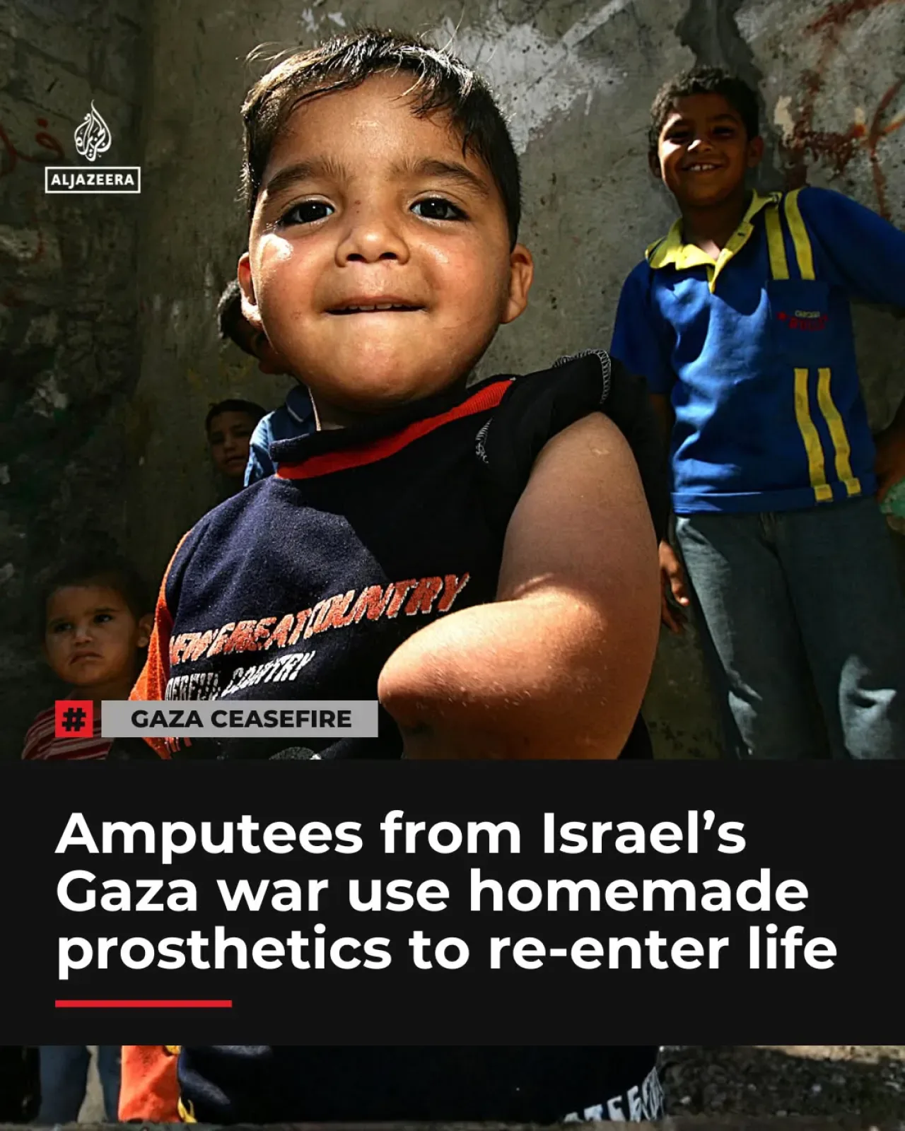 Gaza'da Savaş Mağdurları, Ev Yapımı Protezlerle Hayata Tutunuyor Gaza'da Savaş Mağdurları, Ev Yapımı Protezlerle Hayata Tutunuyor