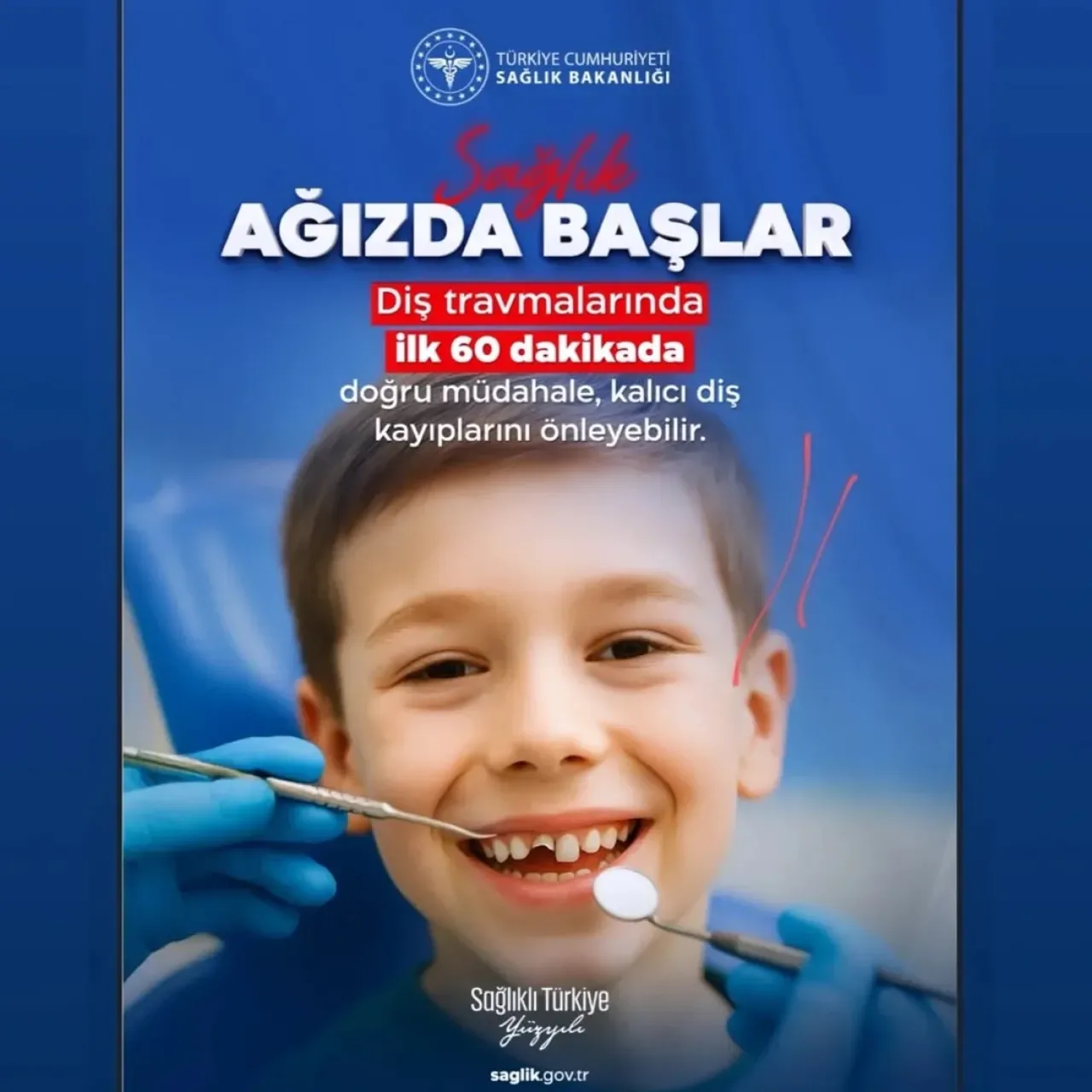 Dental Travma ve Diş Yaralanmaları: Erken Müdahale Hayati Önem Taşıyor Dental Travma ve Diş Yaralanmaları: Erken Müdahale Hayati Önem Taşıyor