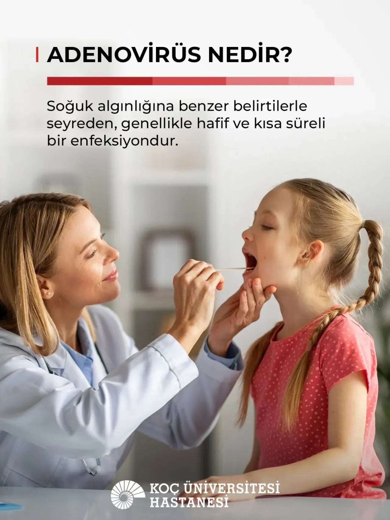 Adenovirüs Enfeksiyonu: Belirtileri ve Ne Zaman Doktora Başvurulmalı? Adenovirüs Enfeksiyonu: Belirtileri ve Ne Zaman Doktora Başvurulmalı?