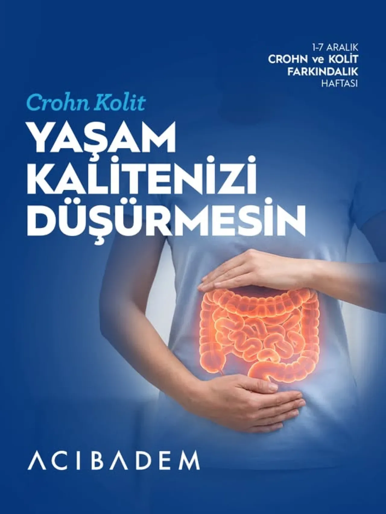 Crohn ve Kolit Hastalığı: Belirtileri ve Tedavi Yöntemleri Crohn ve Kolit Hastalığı: Belirtileri ve Tedavi Yöntemleri