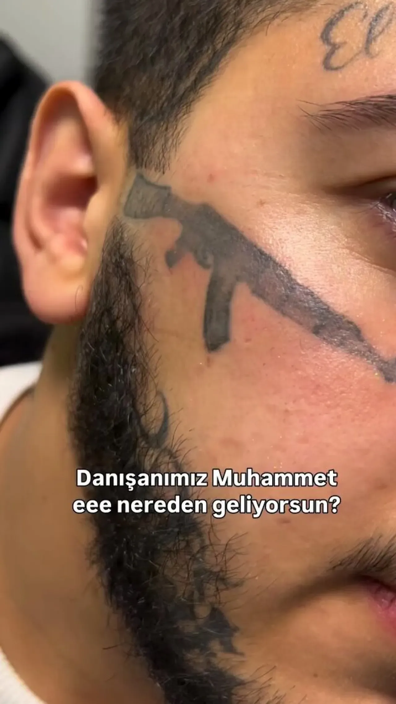 Yüzündeki Keleş Dövmesinden Pişmanlık: Silme Arayışındaki Kişinin Hikayesi Yüzündeki Keleş Dövmesinden Pişmanlık: Silme Arayışındaki Kişinin Hikayesi