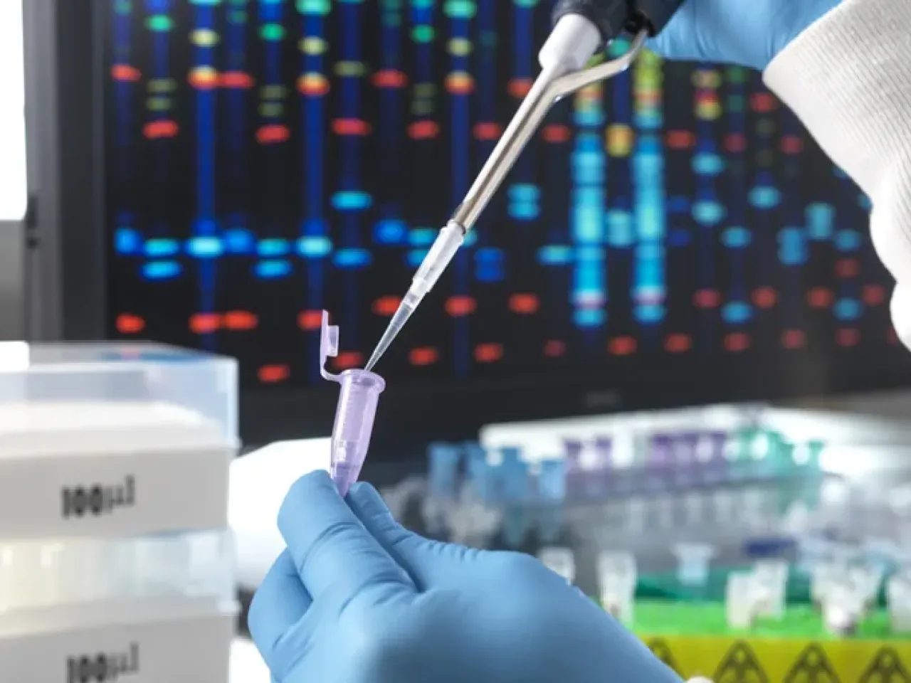 Bulgaristan'da Nadir Hastalık Tanısı İçin Genetik Test Erişiminde Büyük Sıkıntı Bulgaristan'da Nadir Hastalık Tanısı İçin Genetik Test Erişiminde Büyük Sıkıntı