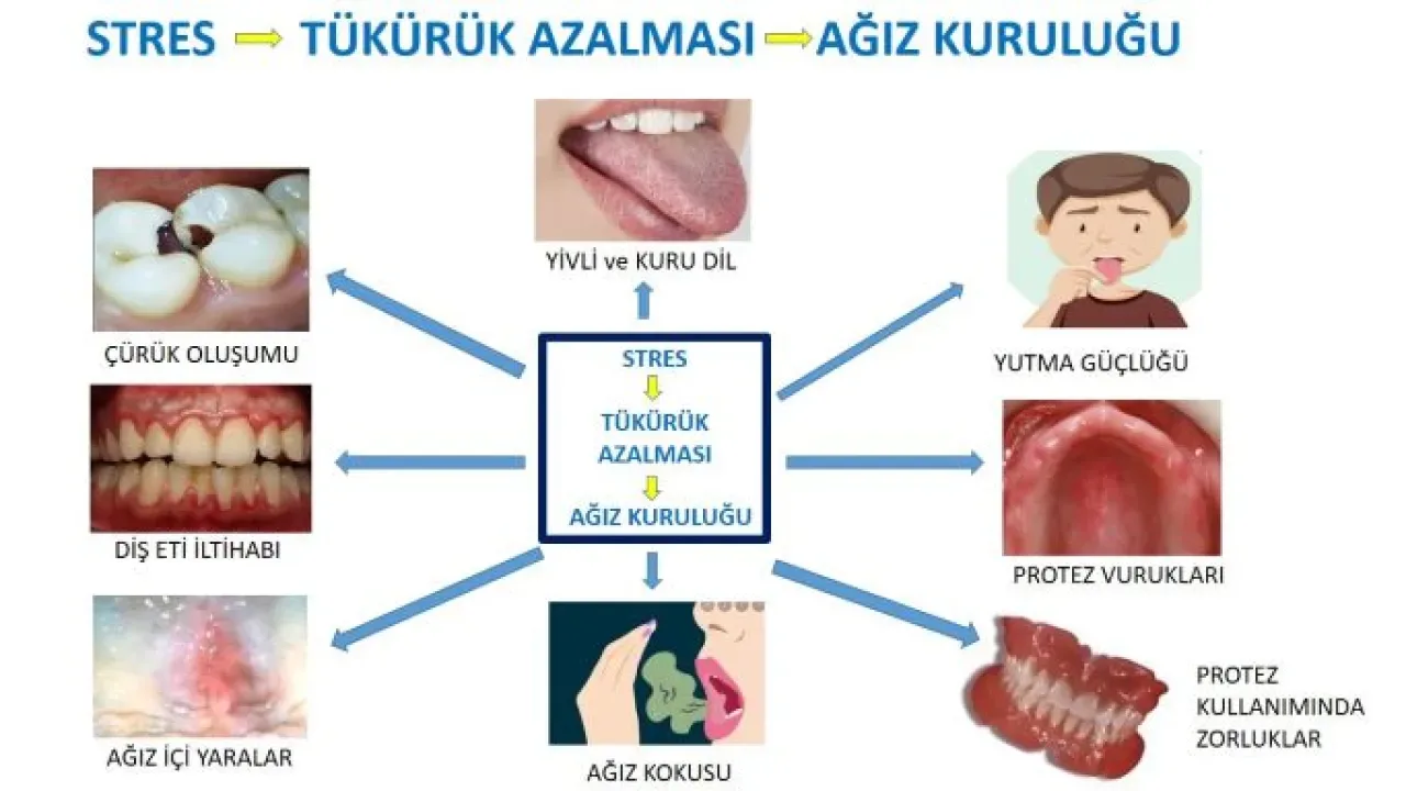 Diş İpi ile Stres Ölçen Devrimsel Teknoloji: Akıllı Diş Plağı Diş İpi ile Stres Ölçen Devrimsel Teknoloji: Akıllı Diş Plağı