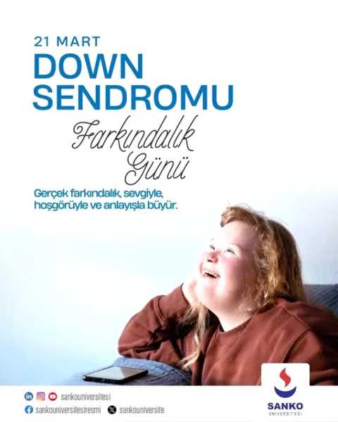 Down Sendromu'na İlişkin Çarpıcı Açıklama