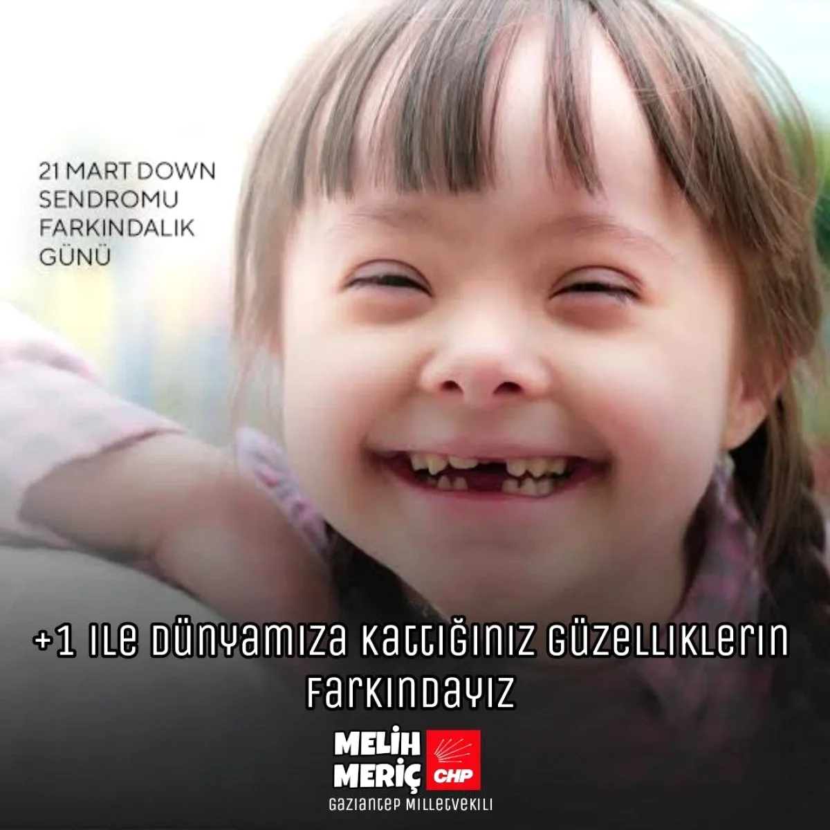 Milletvekili Meriç'ten Down Sendromu İçin "Hastalık Değil" Vurgusu Milletvekili Meriç'ten Down Sendromu İçin "Hastalık Değil" Vurgusu