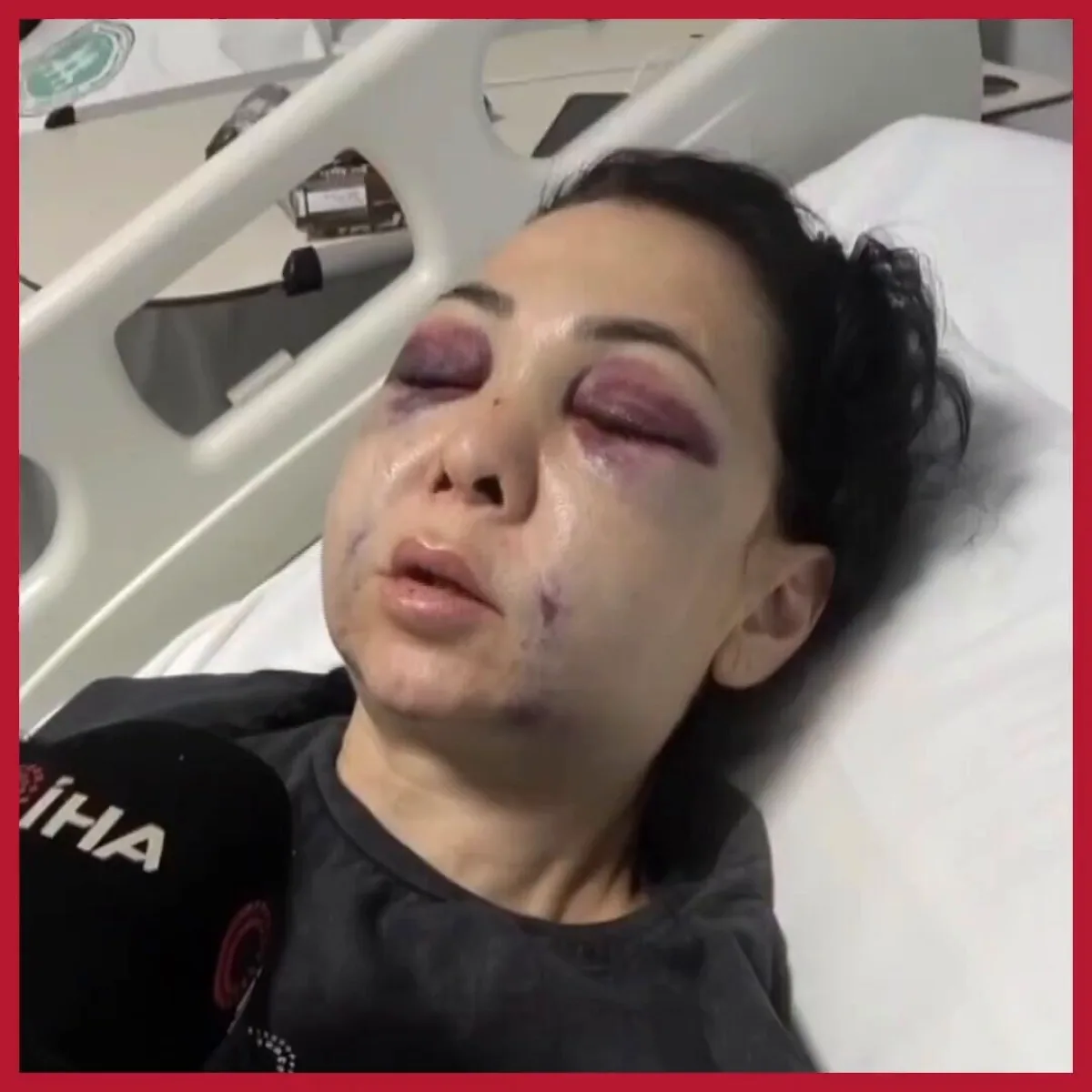 "Küfür Etmeyin" Dediği İçin Anne ve Oğluna Feci Saldırı "Küfür Etmeyin" Dediği İçin Anne ve Oğluna Feci Saldırı