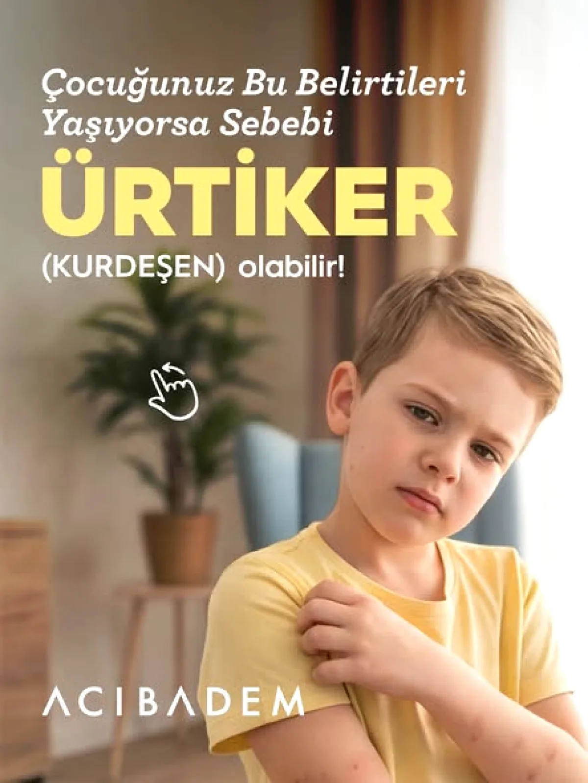 Çocuklarda Aniden Çıkan Döküntülere Dikkat Çocuklarda Aniden Çıkan Döküntülere Dikkat