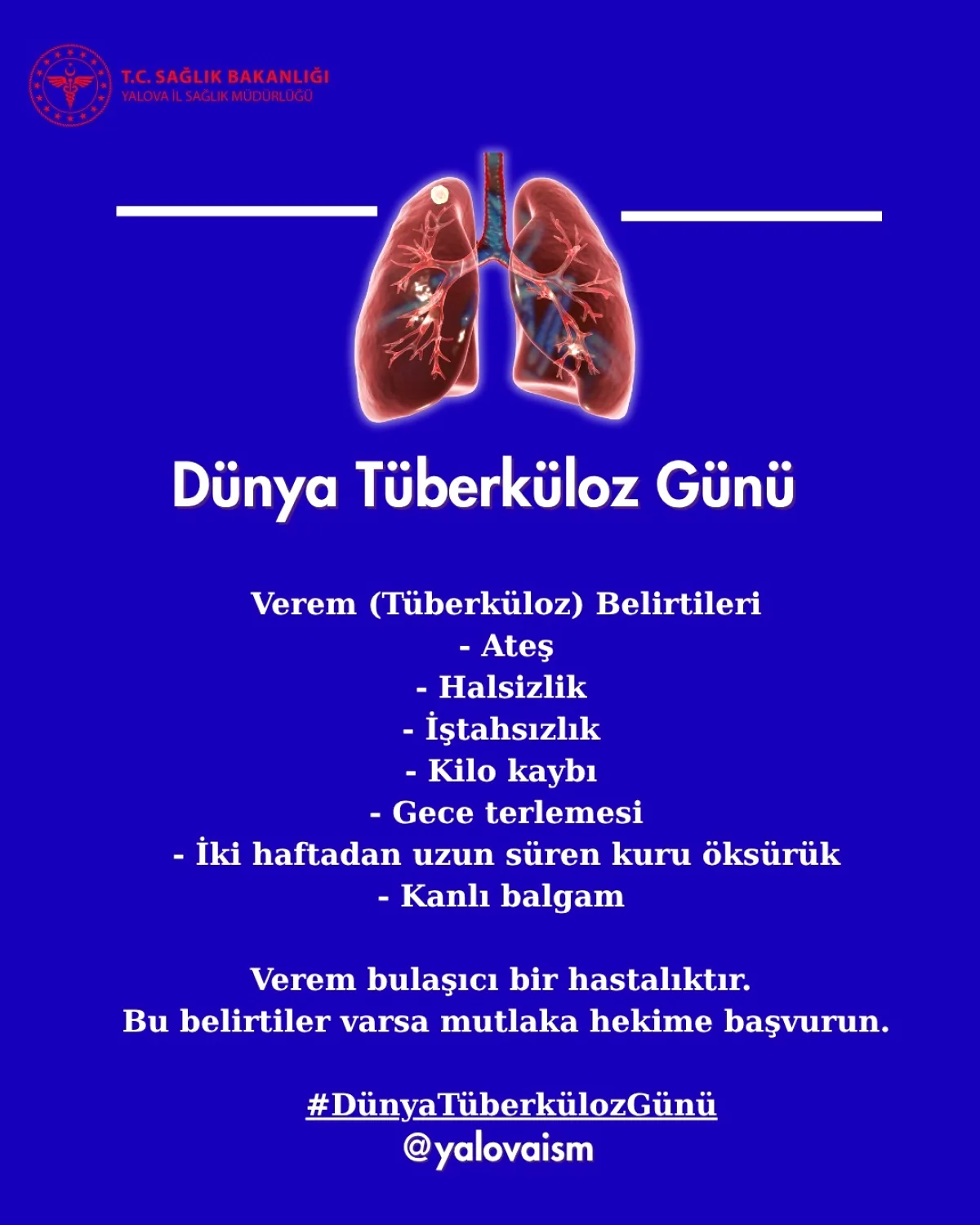 Yalova'da Verem Alarmı: Bu Belirtiler Varsa Dikkat! Yalova'da Verem Alarmı: Bu Belirtiler Varsa Dikkat!