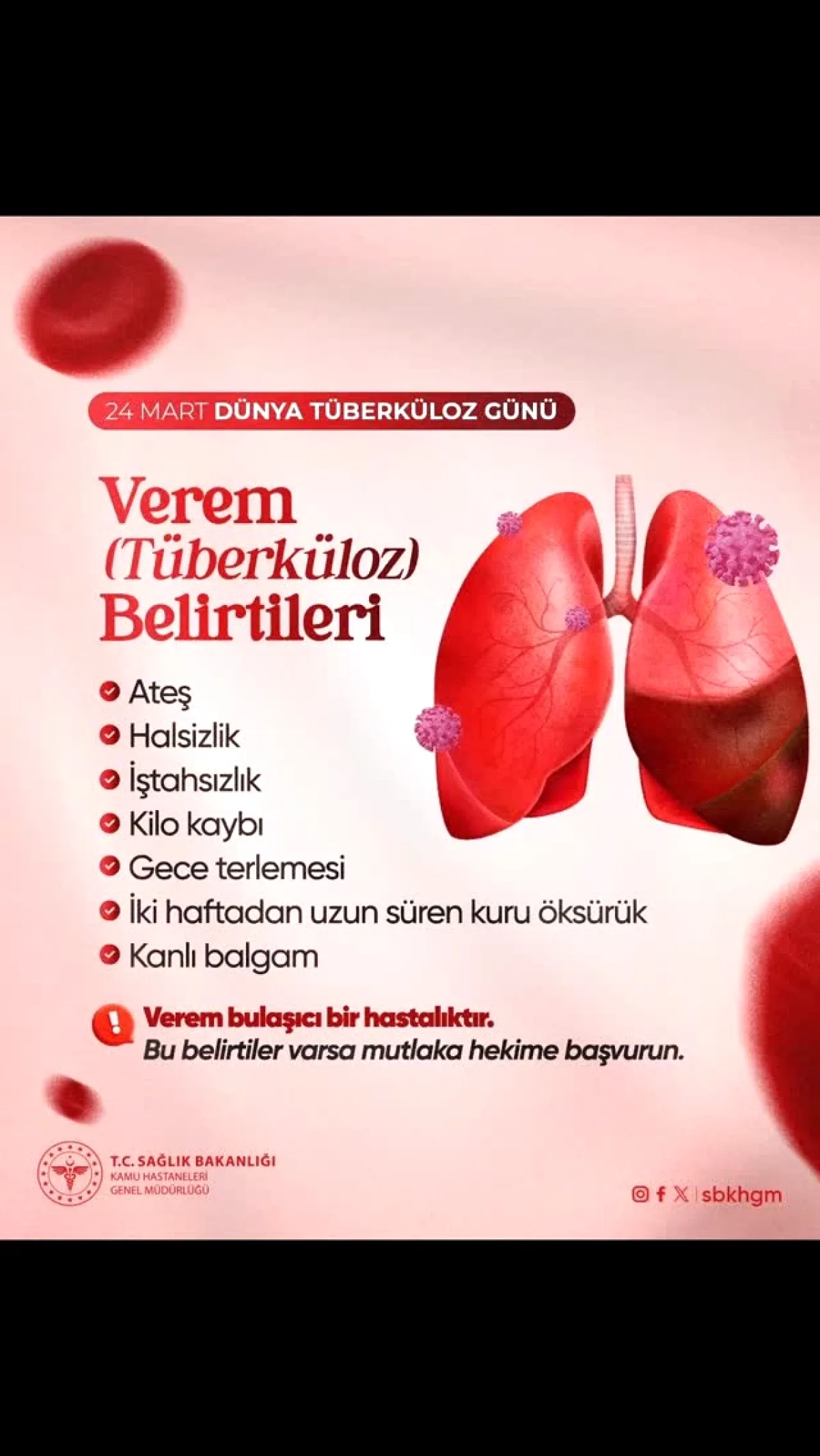 Sarıyer'de Verem Uyarısı: Bu Belirtilere Dikkat! Sarıyer'de Verem Uyarısı: Bu Belirtilere Dikkat!