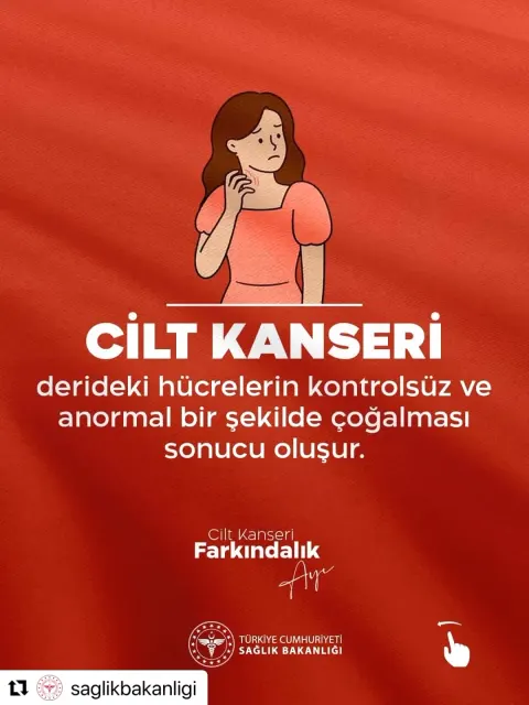Beşiktaş'ta Mayıs'ta Cilt Kanseri Farkındalık Seferberliği