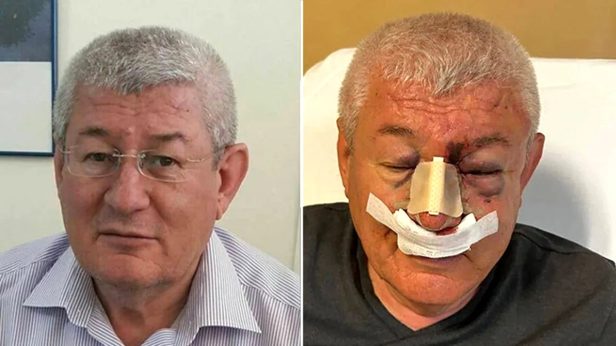 Uşak'ta SOL Parti İl Sözcüsüne Saldırı: "Muhalefete Gözdağı" İddiası Uşak'ta SOL Parti İl Sözcüsüne Saldırı: "Muhalefete Gözdağı" İddiası