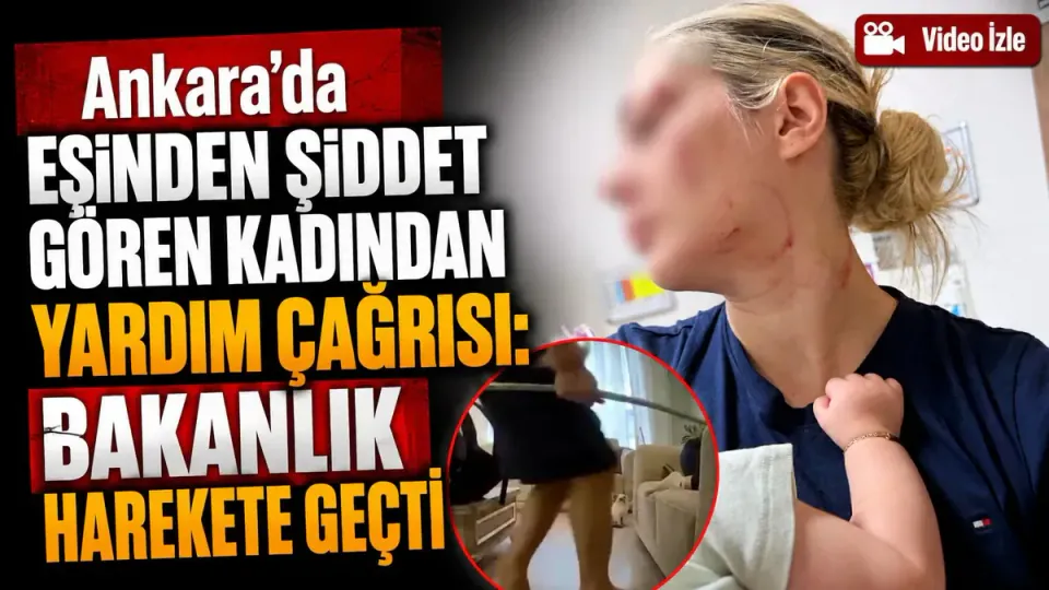 Ankara'da şiddet gören kadına Bakanlık'tan destek: Hukuki süreç başlatıldı görseli