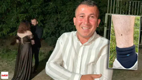 Tokat'ta İnanılmaz Olay: Bacağındaki Keneyi Yüzük Merasimine Kadar Bekletti