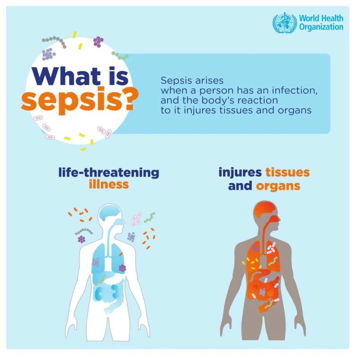 Dünya Sepsis Günü Dünya Sepsis Günü
