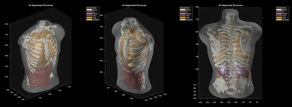 Midjourney'den Devrimsel Adım: Yapay Zekadan Tüm Vücut Ultrason Tarayıcıya görseli