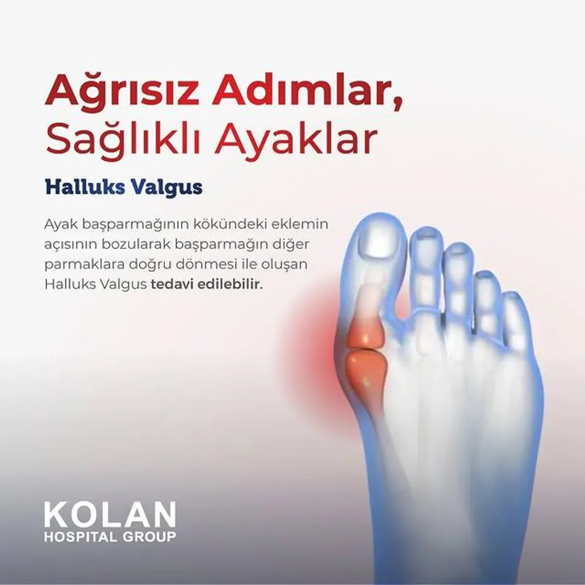 Ayak Deformitelerinde Doğru Ameliyat Yöntemi Nasıl Belirlenir? Ayak Deformitelerinde Doğru Ameliyat Yöntemi Nasıl Belirlenir?