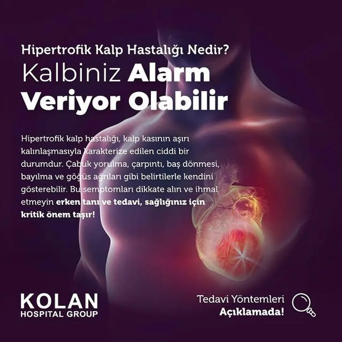 Hipertrofik Kalp Hastalığı: Tedavi Yöntemleri Hipertrofik Kalp Hastalığı: Tedavi Yöntemleri