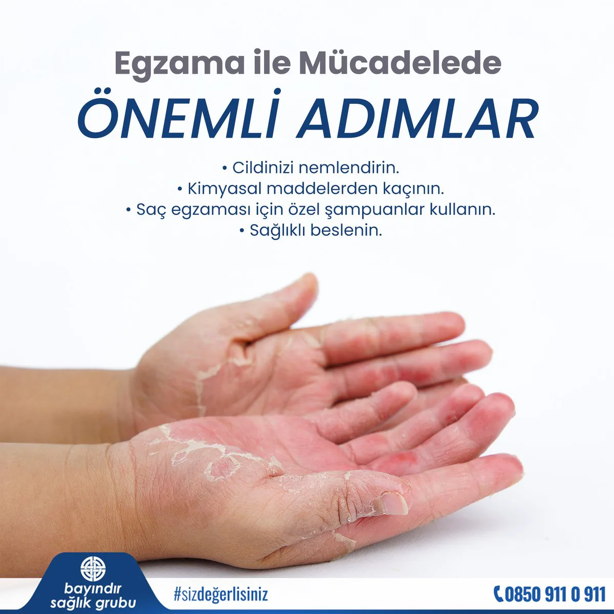 Egzama Nedir ve Nasıl Yönetilir? Egzama Nedir ve Nasıl Yönetilir?