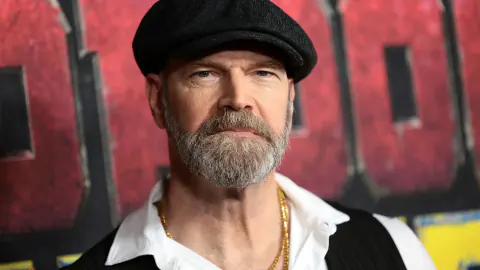 X-Men Yıldızı Tyler Mane'in Kansız Teşhisi: Erkeklerde Meme Kanseri Belirtileri