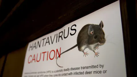 Jake Rosmarin Hantavirus Karantinası Hakkında Gerçekler: İddialar ve Olgular