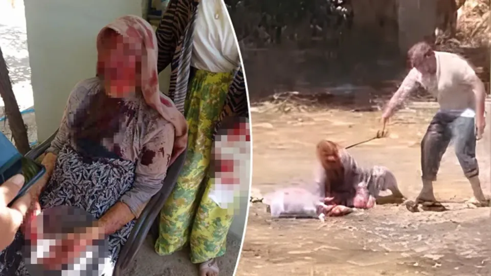 Şanlıurfa'da 85 Yaşındaki Anneye Dehşet: Oğlu Tarafından Öldüresiye Dövdü görseli