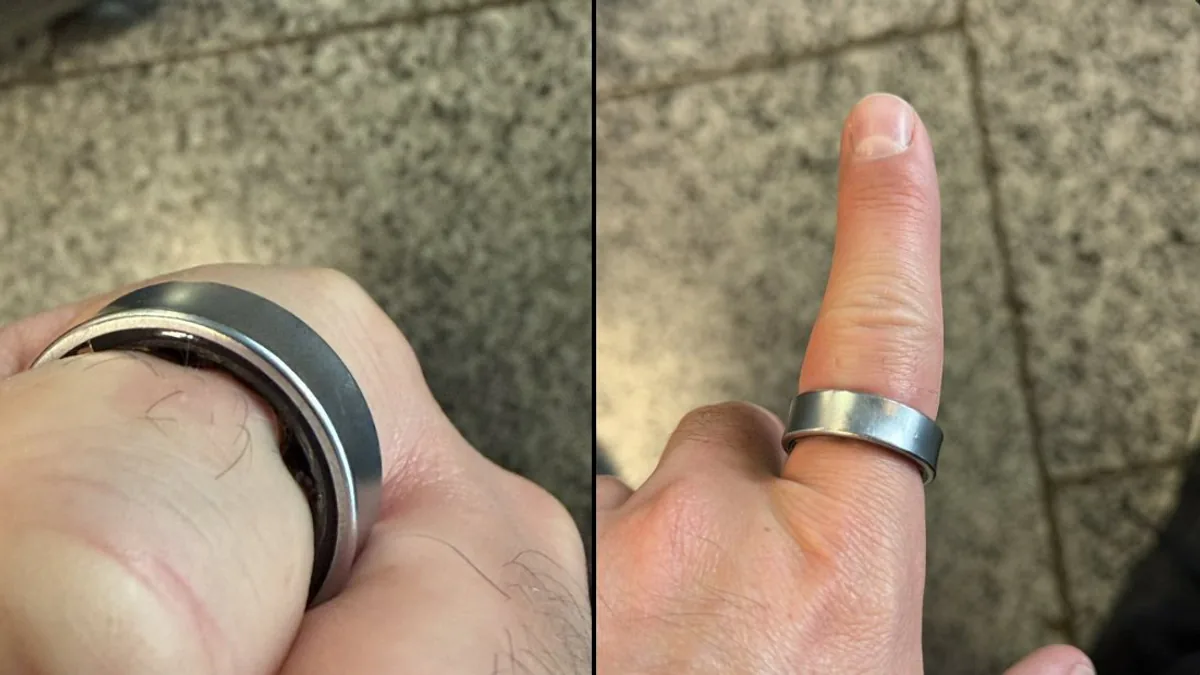 Samsung Galaxy Ring Kullanıcısının Parmağında Şişerek Sıkıştı Samsung Galaxy Ring Kullanıcısının Parmağında Şişerek Sıkıştı