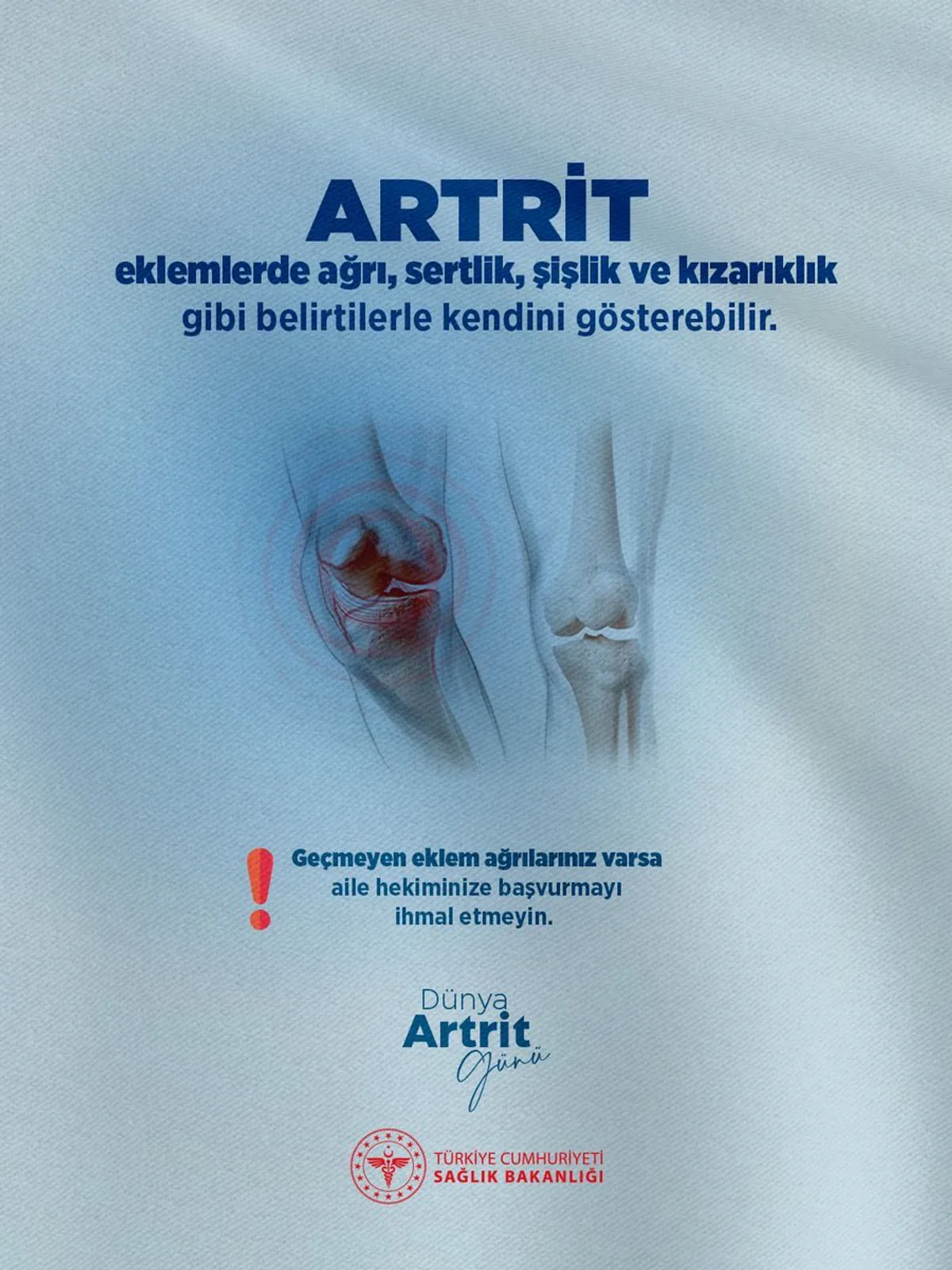 Artrit Hastalığına Dikkat: Eklem Ağrıları ve Belirtileri Hakkında Bilinmesi Gerekenler Artrit Hastalığına Dikkat: Eklem Ağrıları ve Belirtileri Hakkında Bilinmesi Gerekenler