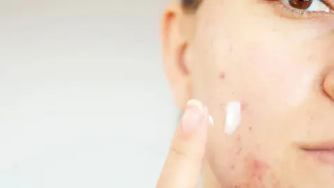 CeraVe'nin Sivilce Ürünlerinde Kanserojen Madde İddiası: ABD'de Dev Dava Süreci