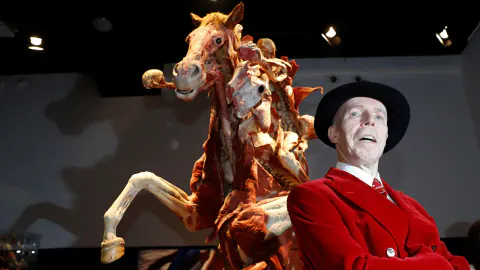 Plastinasyonun Öncüsü Gunther von Hagens Hayatını Kaybetti