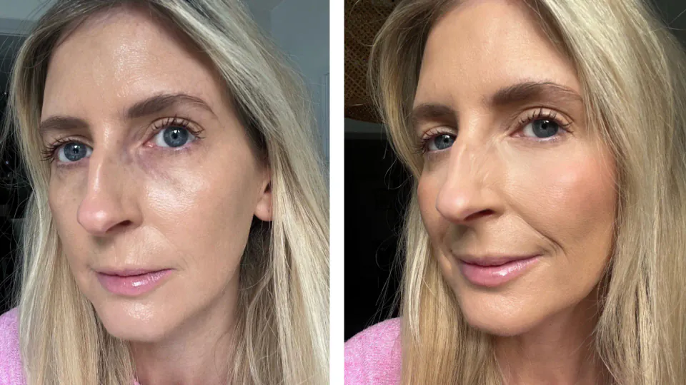 Alt göz concealer hatası sizi yaşlandırıyor: Editörlerin 'sıfır çizgi' uygulama tekniği görseli