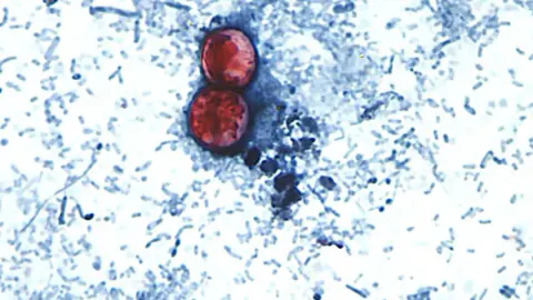 ABD'de Korkutan Salgın: Cyclospora Paraziti 31 Eyalete Yayıldı