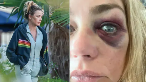 Denise Richards'tan Şok İtiraf: 'Evlendiğim Adamla Ayrıldığım Adam Bambaşka Kişilerdi'