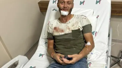 Antalya Serik'te gürültü tartışması sopalı kavgaya döndü: 5 kişi gözaltında