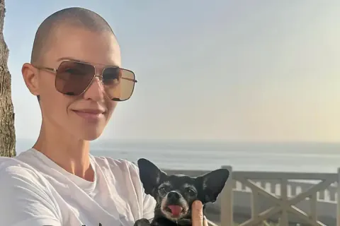 Ruby Rose Havuz Kazası Geçirdi: İki Kaburgası Kırıldı