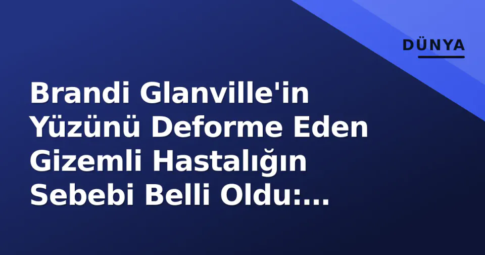 Brandi Glanville'in Yüzünü Deforme Eden Gizemli Hastalığın Sebebi Belli Oldu: Parazit ve İmplant İlişkisi Ortaya Çıktı görseli