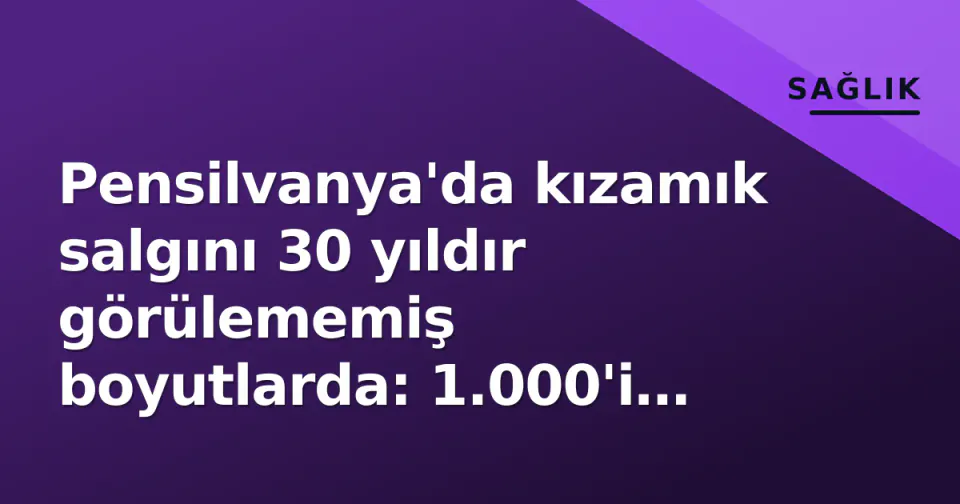 Pensilvanya'da kızamık salgını 30 yıldır görülememiş boyutlarda: 1.000'i aşkın vaka görseli