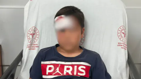 Bolu'da Parkta Oynayan Çocuğun Üzerine Demir Direk Devrildi