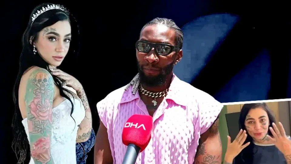 İstanbul'da Estetik Operasyonu Son ı: Mozambikli Sanatçı Adalet İstiyor görseli